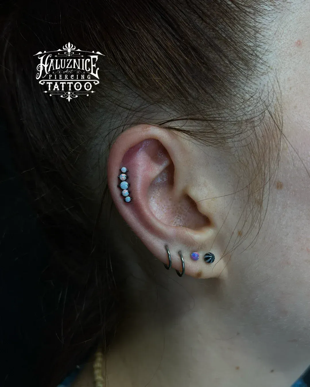 Helix + Lobe