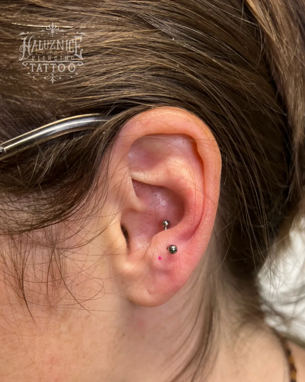 Antitragus