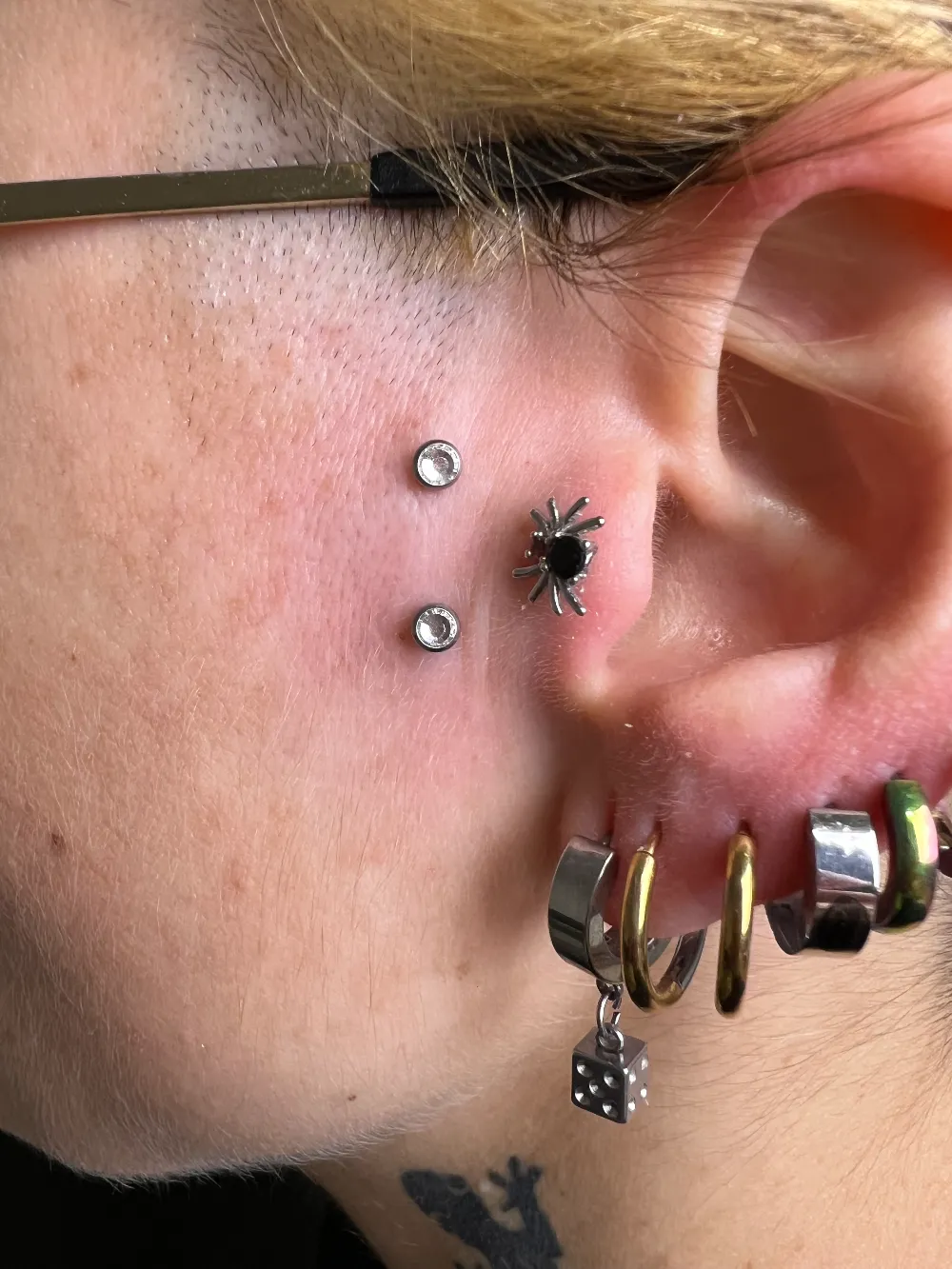 Microdermal