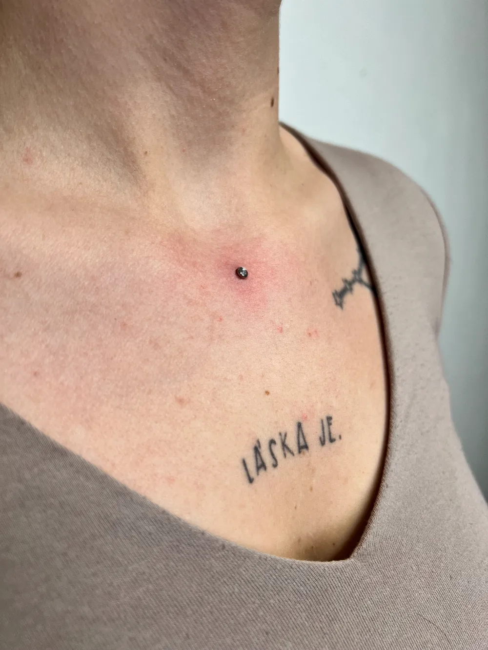 Mikrodermal