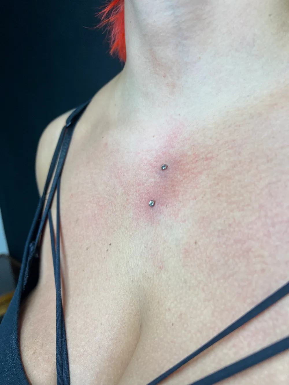 Microdermal